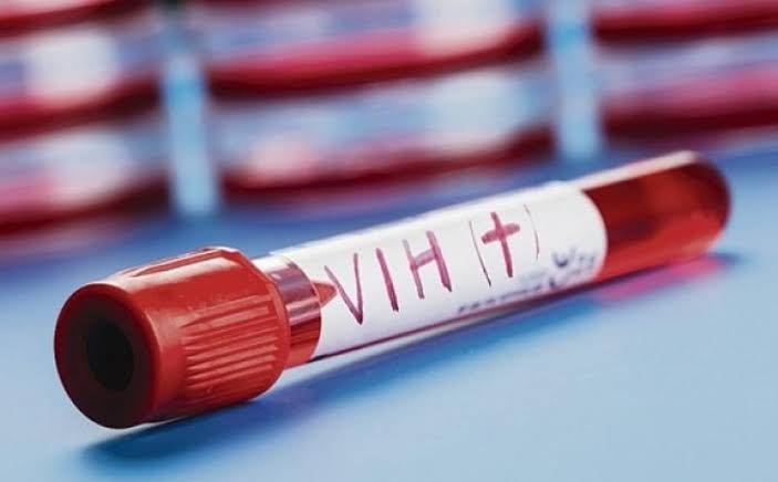770 mil personas murieron en el 2018 por VIH: ONU